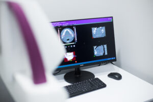 Видалення зуба мудрості у Дніпрі, Кам’янському та Ужгороді: коли це необхідно